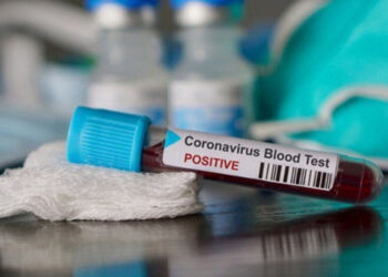 Reagen di Bontang Dipatok Rp 109 Ribu, Dinkes Berikesempatan Habiskan Stok Lama