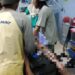 Alami Luka Bakar 40 Persen, Buruh Proyek di Telihan Sudah Siuman