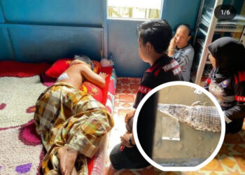 Warga Muara Badak Diserang Buaya Saat Bersihkan Kapal, Punggung Penuh Luka Gigitan