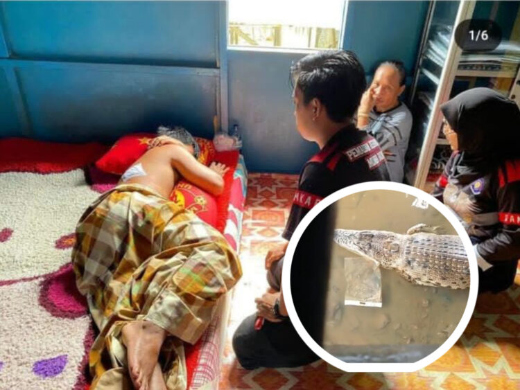 Warga Muara Badak Diserang Buaya Saat Bersihkan Kapal, Punggung Penuh Luka Gigitan