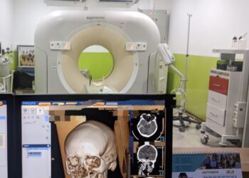 Kondisi Otak Dipengaruhi Kebiasaan Membaca, Penjelasan Dokter Radiologi RSUD Bontang