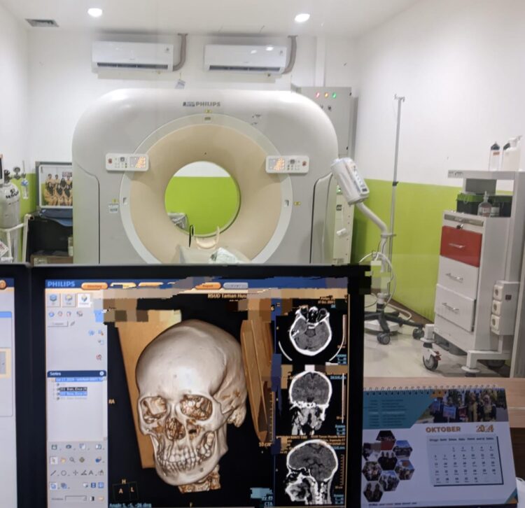 Kondisi Otak Dipengaruhi Kebiasaan Membaca, Penjelasan Dokter Radiologi RSUD Bontang