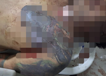 Pria Bertato Tewas Ditembak OTK di Imam Bonjol Samarinda, 5 Peluru Bersarang