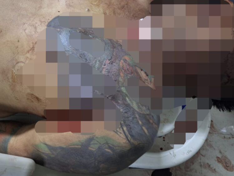 Pria Bertato Tewas Ditembak OTK di Imam Bonjol Samarinda, 5 Peluru Bersarang