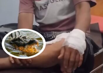 Cerita Warga Gang Arwana Bontang Diterkam Buaya, Selamat Karena Ditolong Istri