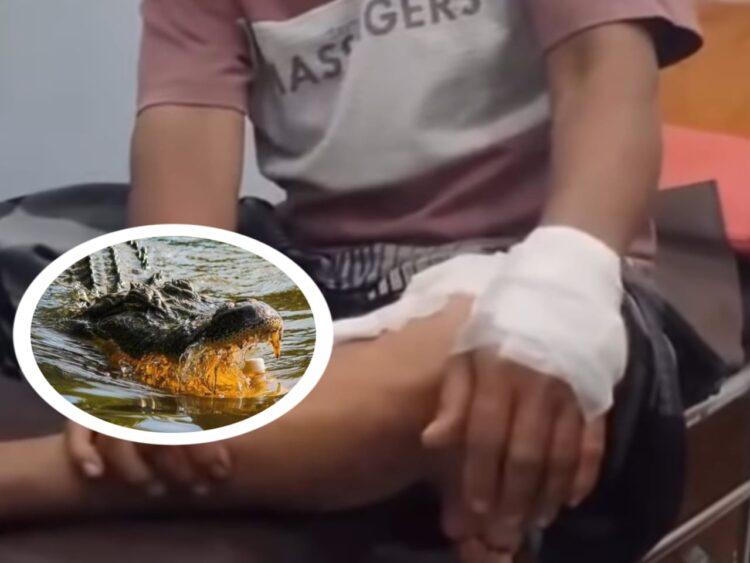 Cerita Warga Gang Arwana Bontang Diterkam Buaya, Selamat Karena Ditolong Istri