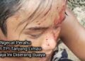 Lagi Ngecat Kapal Dekat TPI Tanjung Limau, Remaja Ini Diserang Buaya