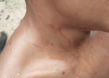 Cerita Warga, Ganasnya Buaya di Tanjung Limau Bontang Saat Menyerang Remaja