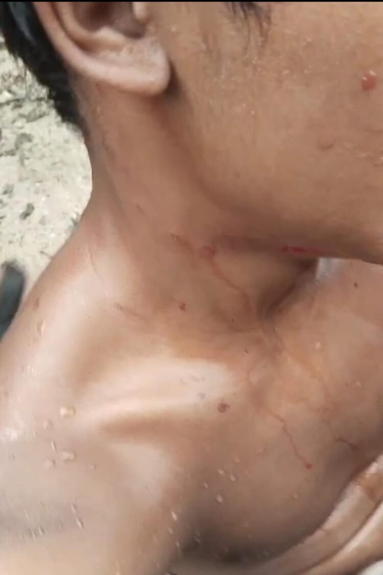 Cerita Warga, Ganasnya Buaya di Tanjung Limau Bontang Saat Menyerang Remaja