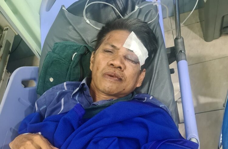 Guru Korban Kekerasan di Bukit Kusnodo Cabut Pernyataan Terkait Begal, Kenal Pelaku