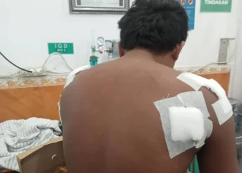 Cerita Nelayan Usai Diterkam Buaya di Pulau Kedindingan, Minta Predator Tak Diserang