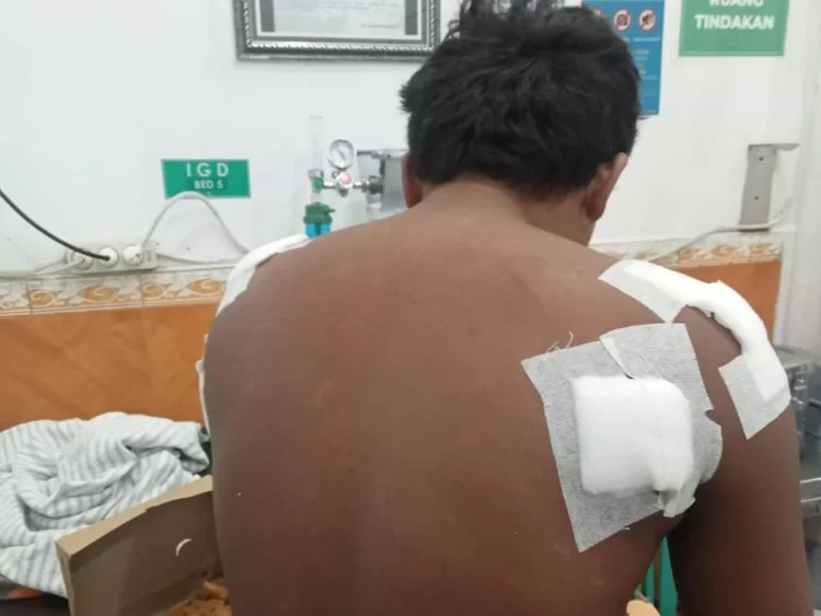 Cerita Nelayan Usai Diterkam Buaya di Pulau Kedindingan, Minta Predator Tak Diserang